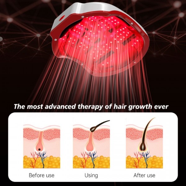 Laser Hair Growth Cap,Red Light Therapy Cap TW147,Laser Hair Growth System Hair Loss Treatments for Men and Women,Hair Regrowth Treatments Laser Cap (White)